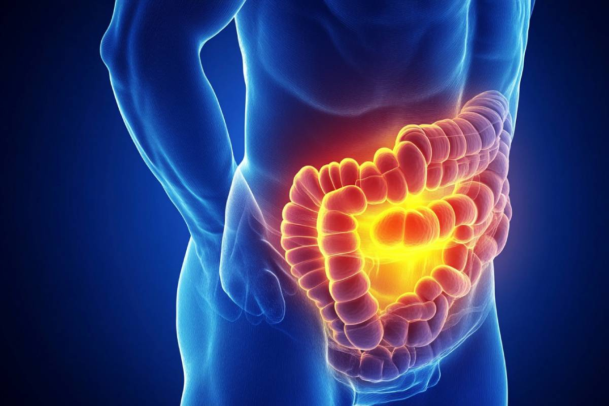 7 Síntomas de Cáncer de Intestino Que Nunca Debes Ignorar